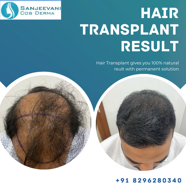 Cover photo of Sanjeevani Cos Derma (Hair Transplant & Skin Clinic)